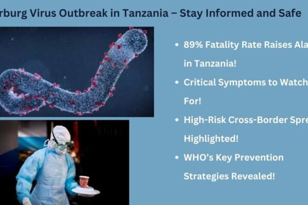 Top 10 Insights into the Marburg Virus Outbreak in Tanzania – Stay Informed and Safe!